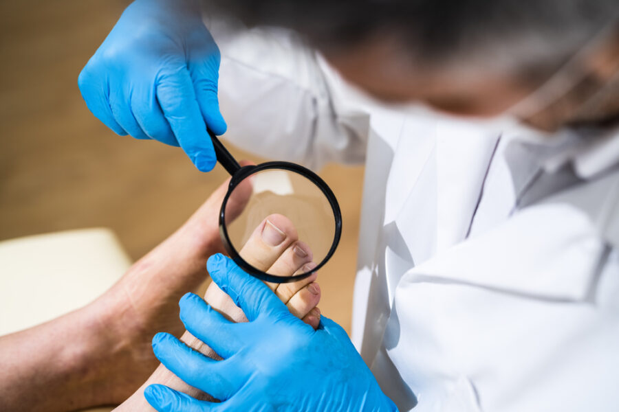 What causes an ingrown toenail? 6 Causes to Watch Out For