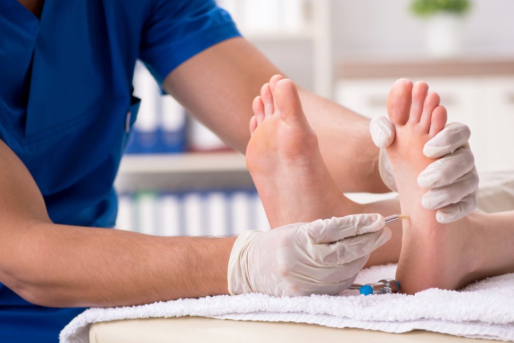 How to get rid of calluses on feet? 4 Professional Treatment Options